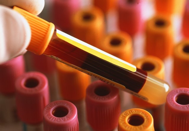 Kako da znate imate li 